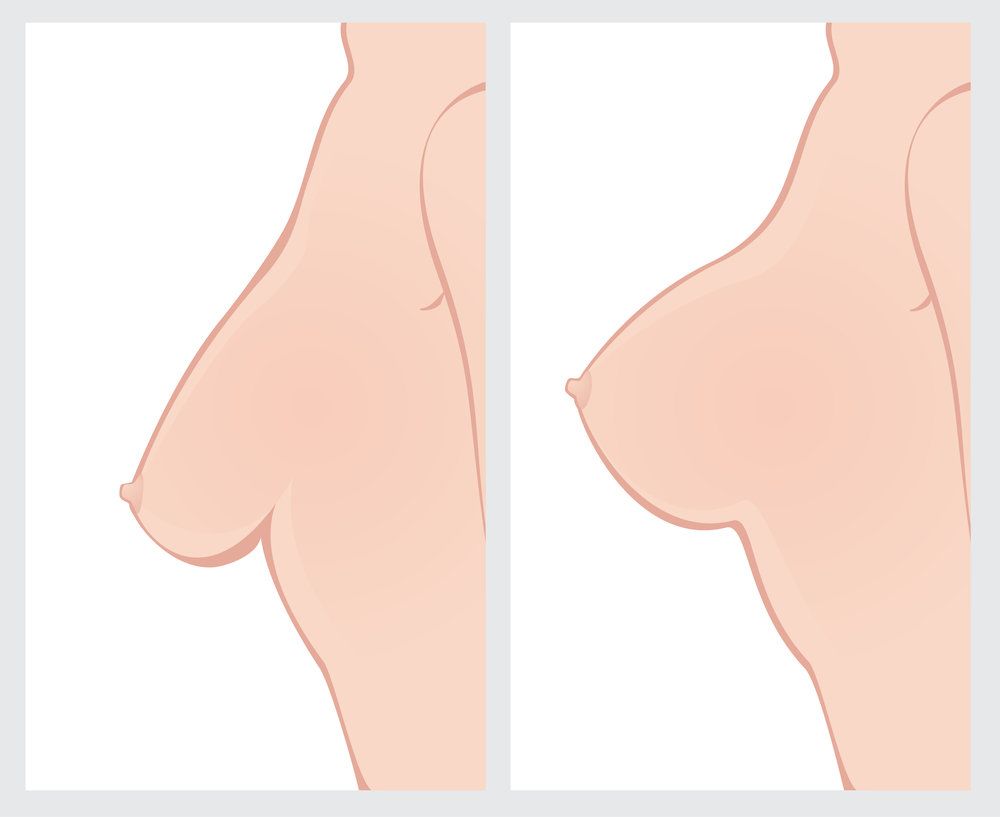 Breast changes during and after pregnancy
