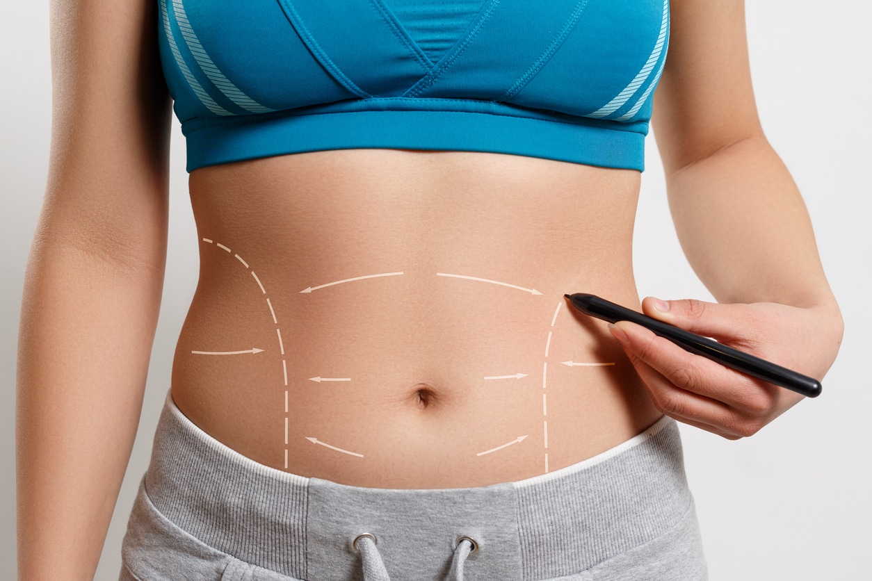 Am I a Candidate for a Reverse Abdominoplasty?
