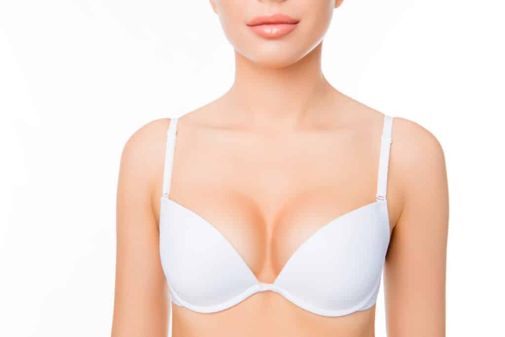 A cropped shot of a woman in a white bra after breast implant revision surgery